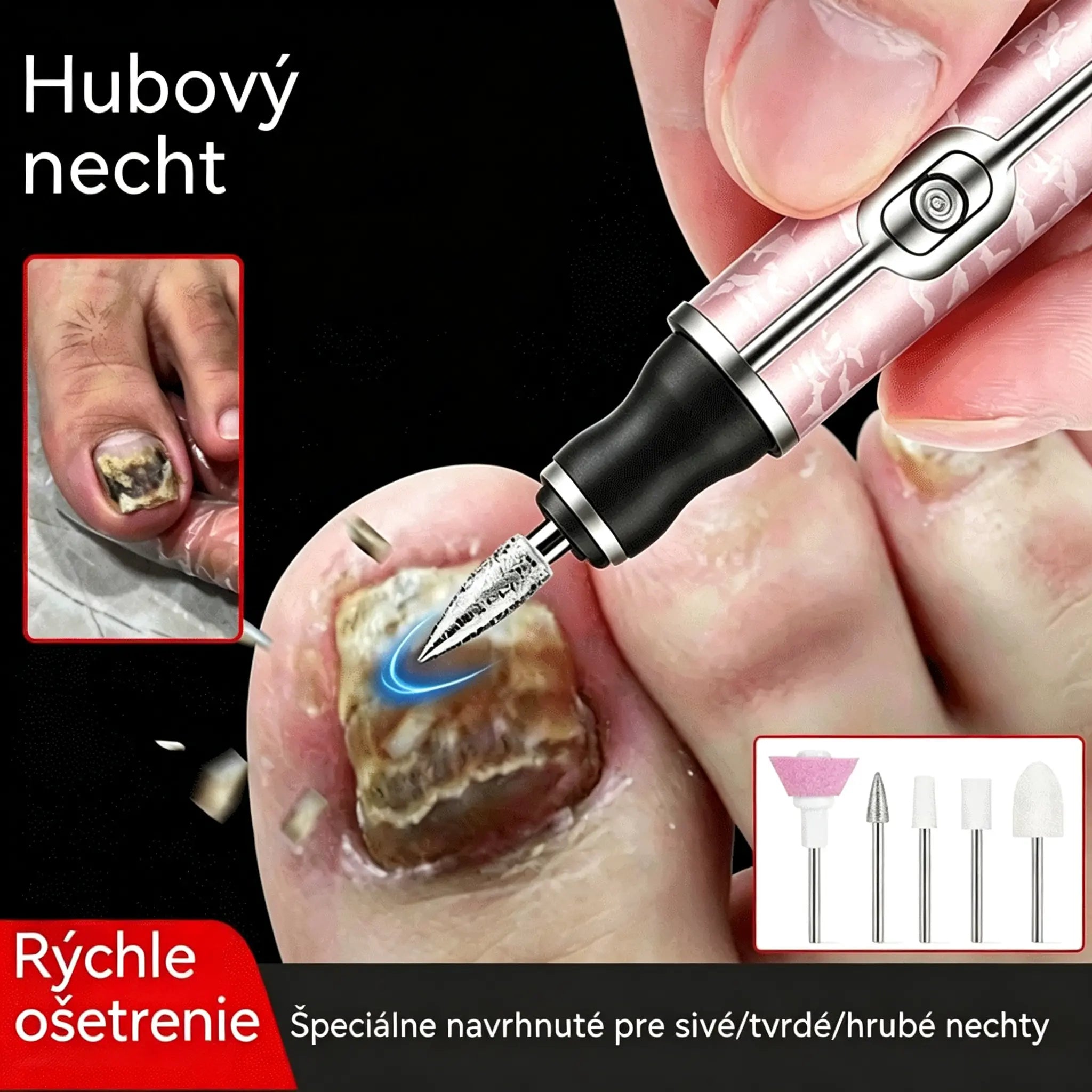 50% sleva 💅👍 Elektrický pilník na nehty pro manikúru a léčbu onychomykózy